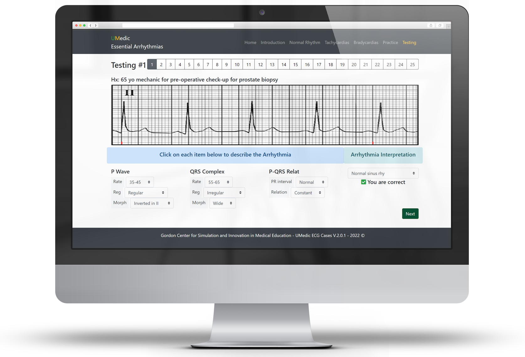 Gordon-Center-UMedic_ECG